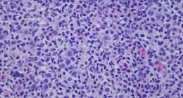 癌症“疫苗”也许不再是梦想，研究获得初步成功或可治愈癌症