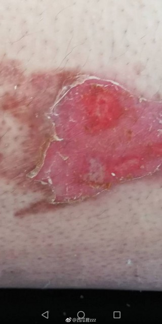 img-3b45cdacf047a4874d87bd2c2a56d803