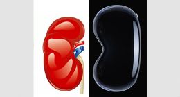 长的像“肾”？售价近2W5人民币的苹果头显Apple Vision Pro来了！