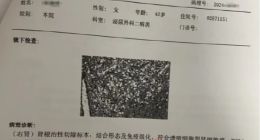 张晓玲律师回应爱康国宾起诉：将征集1万名爱康体检受害人，对其发起公益诉讼